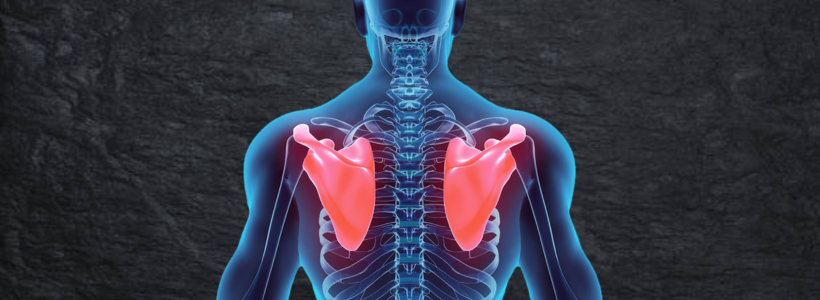 Douleur à l'Omoplate : Causes et Solutions pour la Soulager